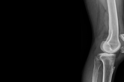 Eklem İçi Enjeksiyonlar ve Hastane Bahçesindeki Çantacılar