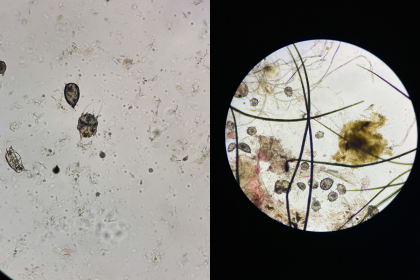 Görmemekte Direnilen Salgın: UYUZ